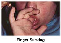 Finger Sucking